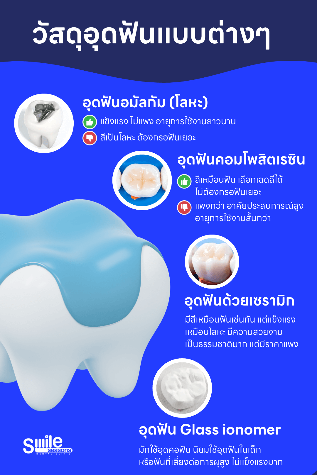 การอุดฟันเจ็บไหม มีกี่แบบ ราคาเท่าไหร่ ใช้ประกันสังคมได้ไหม?